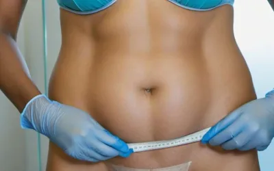 Eliminación de grasa en pubis: métodos y tratamientos disponibles ¡Reserva tu consulta ahora!