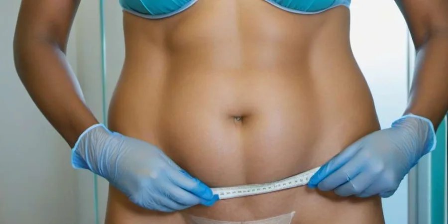 Consigue el vientre plano que siempre has deseado: Clínica de cirugía estética para abdominoplastia