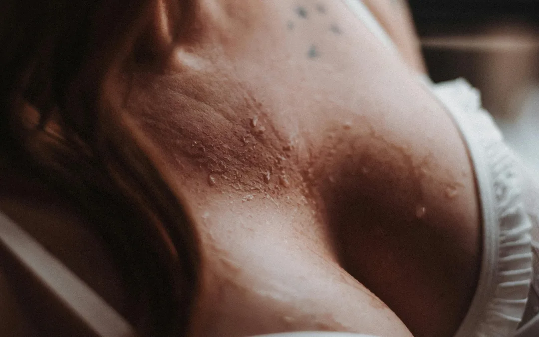 Breast lift en Madrid: Qué es y cuáles son sus resultados